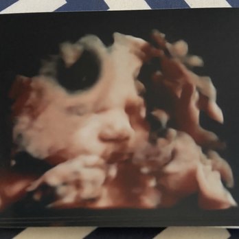 Womb With A View - So happy with Judy, and so happy with our pictures! - Ultrasound Imaging Centers Near Me - Lancaster, Pennsylvania