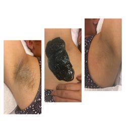 Zarabella Skincare - Underarm wax