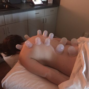 Serendipitous Souls - 5 mins of cupping is = 30 mins of deep tissue massage. - Massage Therapy Near Me - Peabody, Massachusetts Serendipitous Souls - 5 mins of cupping is = 30 mins of deep tissue massage. - Massage Therapy Near Me - Peabody, Massachusetts