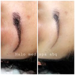 Halo Med Spa - Pre and post !