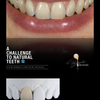 Charlotte Dentist - Steven H. Ghim, DMD - General Dentistry Near Me - Charlotte, North Carolina Charlotte Dentist - Steven H. Ghim, DMD - General Dentistry Near Me - Charlotte, North Carolina