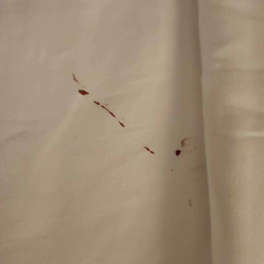 Kinzie Hotel - Blood-stained sheet. - Hotels Near Me - Chicago, Illinois Kinzie Hotel - Blood-stained sheet. - Hotels Near Me - Chicago, Illinois