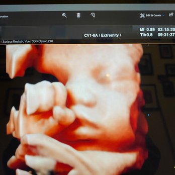 3D-4D Ultrasound Studio Queens - Diagnostic Imaging Near Me - Flushing, New York