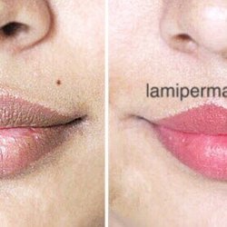 L'AMI Skincare - Lips micropigmentation by L'AMI