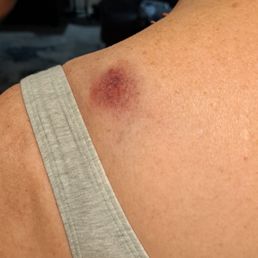 One of the results of today's relaxing swedish massages at SpaLux