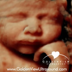 Goldenview Ultrasound 3d 4d HD Chicago - 3d Ultrasound with HD live at 35 weeks