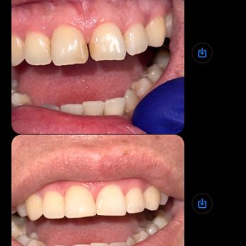 Arbor Dental Group San Jose - General Dentistry Near Me - San Jose, California