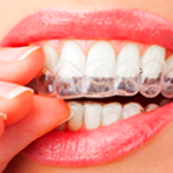 Douglasville Dental Associates