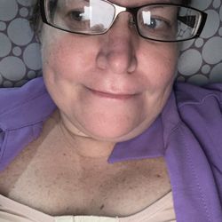 Mia Aesthetics - 6 days post op