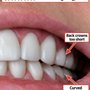 Watson Dental Care