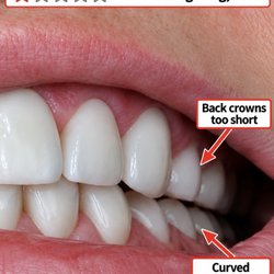 Watson Dental Care - Poor dental work / Watson dental care