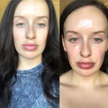 Focal Point Salon & Spa - Left is before, right is after. Bye dull skin, hello GLOW - Hair Salons Near Me - Phoenix, Arizona Focal Point Salon & Spa - Left is before, right is after. Bye dull skin, hello GLOW - Hair Salons Near Me - Phoenix, Arizona