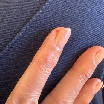Smiley Nail Spa - More cuts to my cuticles. - Nail Salons Near Me - Walnut Creek, California Smiley Nail Spa - More cuts to my cuticles. - Nail Salons Near Me - Walnut Creek, California