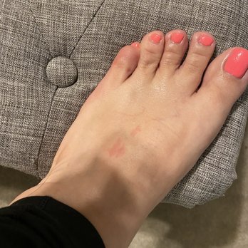 Euphoria Nails & Spa - Red marks on top of feet from nails being dug I to my foot - Nail Salons Near Me - Houston, Texas Euphoria Nails & Spa - Red marks on top of feet from nails being dug I to my foot - Nail Salons Near Me - Houston, Texas