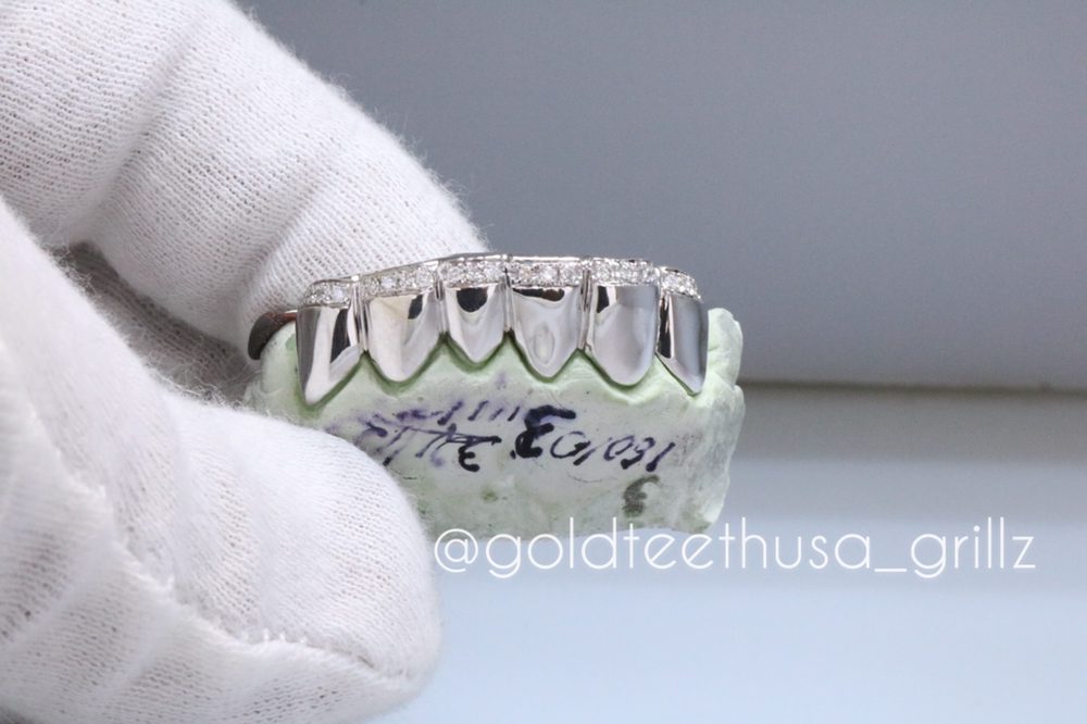 GOLD TEETH USA Updated September 2024 25 Photos & 11 Reviews 36 W