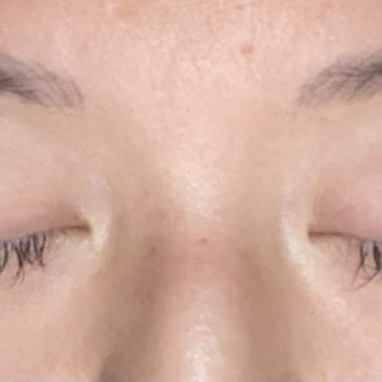 Winkwink Eyelash - 5 weeks after first retouch. Eyelids are red from season allergies. - Eyelash Service Near Me - Flushing, New York Winkwink Eyelash - 5 weeks after first retouch. Eyelids are red from season allergies. - Eyelash Service Near Me - Flushing, New York
