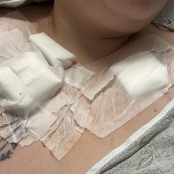 University Hospitals Portage Medical Center - This is me dealing with pain with no pain meds to go home with no thanks to Dr.Fu!