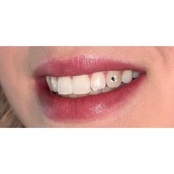 No Filter Beauty Bar - Tooth gems