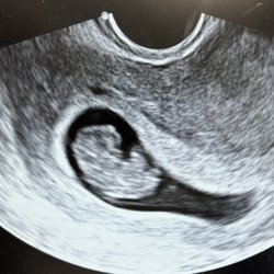 Fora Fertility