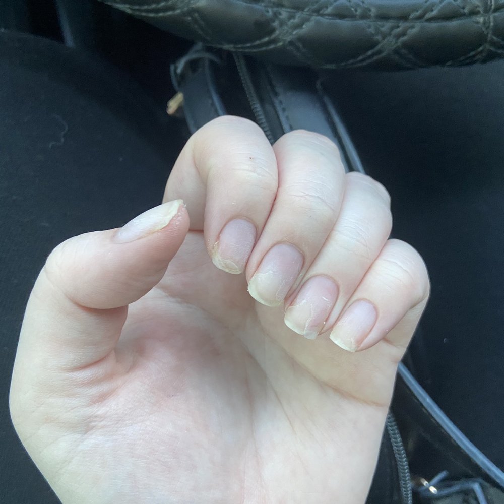 Central Nails - properly removed by neighboring salon - Nail Salons Near Me - Orlando, Florida Central Nails - properly removed by neighboring salon - Nail Salons Near Me - Orlando, Florida