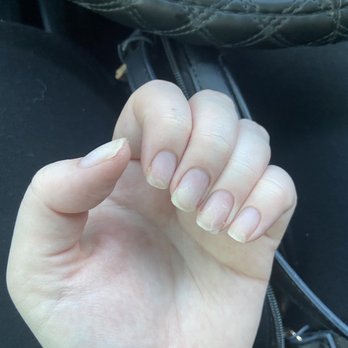 Central Nails - properly removed by neighboring salon - Nail Salons Near Me - Orlando, Florida Central Nails - properly removed by neighboring salon - Nail Salons Near Me - Orlando, Florida