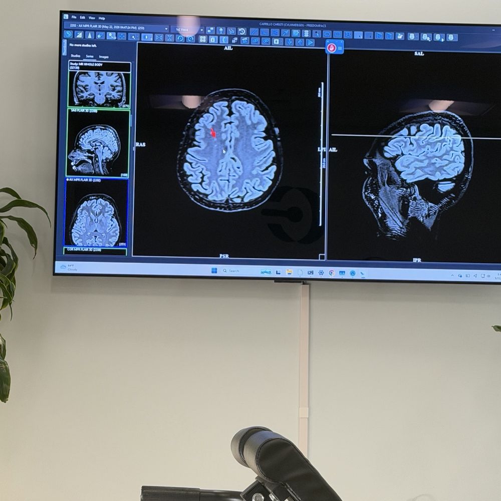 CoreViva - My brain - Diagnostic Imaging Near Me - Newport Beach, California CoreViva - My brain - Diagnostic Imaging Near Me - Newport Beach, California