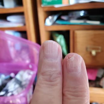 Glamour Nails & Spa - Damage - Nail Salons Near Me - Urbandale, Iowa Glamour Nails & Spa - Damage - Nail Salons Near Me - Urbandale, Iowa