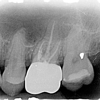New Day Dentistry Denver | Dr. Morgan Greve, DDS - General Dentistry Near Me - Denver, Colorado New Day Dentistry Denver | Dr. Morgan Greve, DDS - General Dentistry Near Me - Denver, Colorado