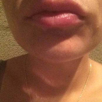Sadi Erfani, MD - Cosmetic Surgeons Near Me - La Mesa, California