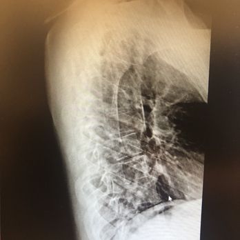 Rush Copley Convenient Care - X Ray that the doctor refused to even see. - Doctors Near Me - Sugar Grove, Illinois Rush Copley Convenient Care - X Ray that the doctor refused to even see. - Doctors Near Me - Sugar Grove, Illinois