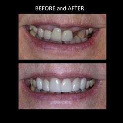Michael A Nguyen DDS MS - Before and After
