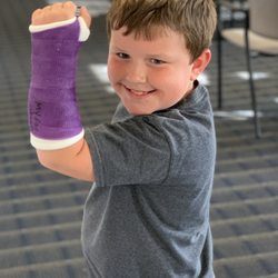 Fayetteville Orthopaedics & Sports Medicine - Jackson's new purple cast!