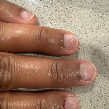 Gelish Nails - Cuticle was damaged and paining a lot - Nail Salons Near Me - Fremont, California Gelish Nails - Cuticle was damaged and paining a lot - Nail Salons Near Me - Fremont, California
