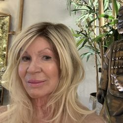Advanced Aesthetics - Me at 71 with fillers etc by Mike Sullivan at Advanced Aesthetics in Centennial Hills, Las Vegas NV