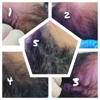 Natural MedSpa And Wellness - Hair growth treatments - Skin Care Near Me - Temple Terrace, Florida Natural MedSpa And Wellness - Hair growth treatments - Skin Care Near Me - Temple Terrace, Florida
