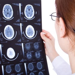 Brain Health Consultants and TMS Center
