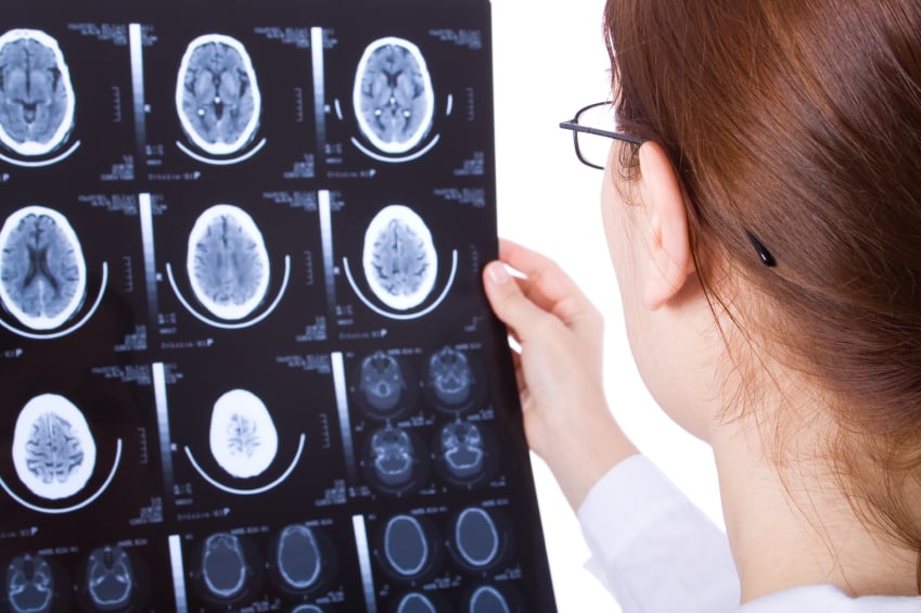 Brain Health Consultants and TMS Center - child therapist in Houston, TX