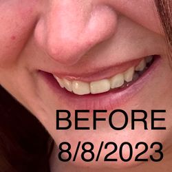 Ascend Dental