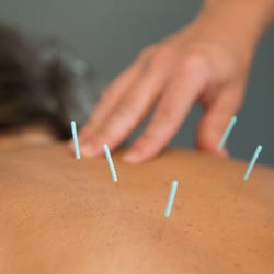 East Bridge Wellness - Acupuncture works!