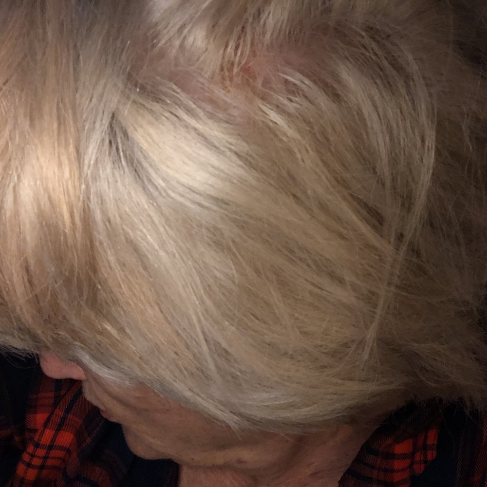 Salon Lofts Kettering Town & Country - Color/s I was also trying to take pictures to show her these awful sores the bleaching caused. - Hair Salons Near Me - Kettering, Ohio Salon Lofts Kettering Town & Country - Color/s I was also trying to take pictures to show her these awful sores the bleaching caused. - Hair Salons Near Me - Kettering, Ohio