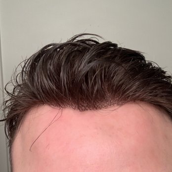 HAIRCLUB - Hair Loss Centers Near Me - Ann Arbor, Michigan HAIRCLUB - Hair Loss Centers Near Me - Ann Arbor, Michigan
