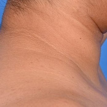 Westlake Plastic Surgery - Cosmetic Surgeons Near Me - Austin, Texas Westlake Plastic Surgery - Cosmetic Surgeons Near Me - Austin, Texas
