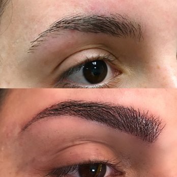 Arched - My before, and after first session with Layla - Skin Care Near Me - Studio City, California Arched - My before, and after first session with Layla - Skin Care Near Me - Studio City, California