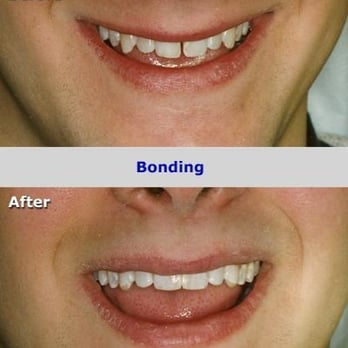Richard J Ruderman, DMD - Oral Surgeons Near Me - Closter, New Jersey