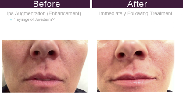 You Rejuvenated by null