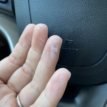 Be My Nails - Yikes!! Cured gel polish on my skin. - Nail Salons Near Me - Milpitas, California