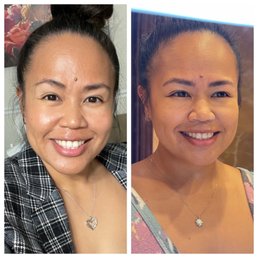 Before and after healed brows