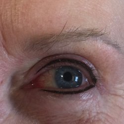 Simply the Best Permanent Cosmetics - Top and bottom eyeliner. Immediately after procedure.