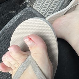 This was after in the parking lot after I left with NO polish because I was still actively bleeding!