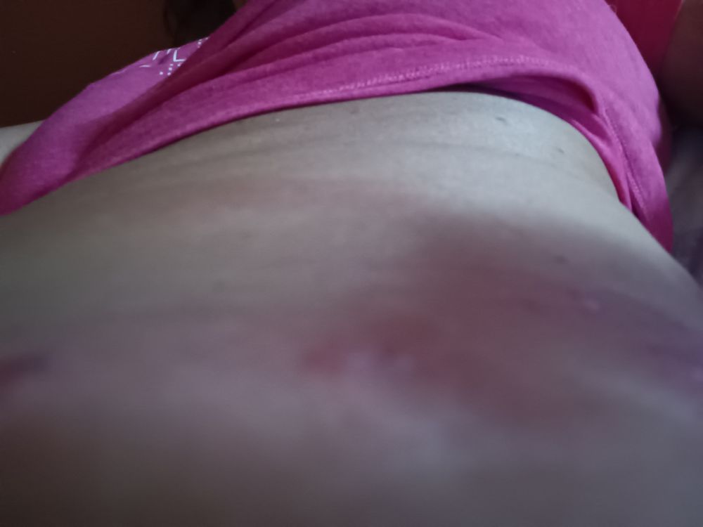 Baystate Medical Center - patient advocate in Springfield, MA